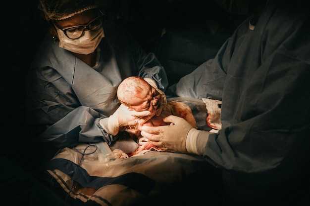 Как правильно подготовиться к родам с использованием эпидуральной анестезии?